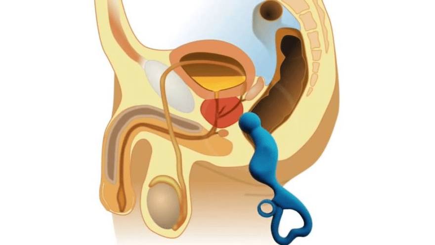 Prostate massage to treat prostatitis