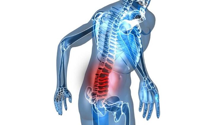 congestive prostatitis inflammation